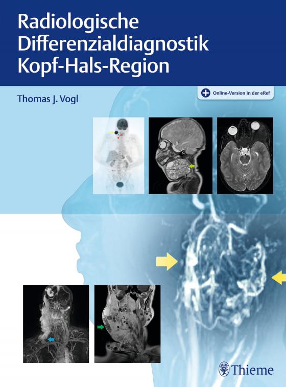 Cover-Bild Radiologische Differenzialdiagnostik Kopf-Hals-Region
