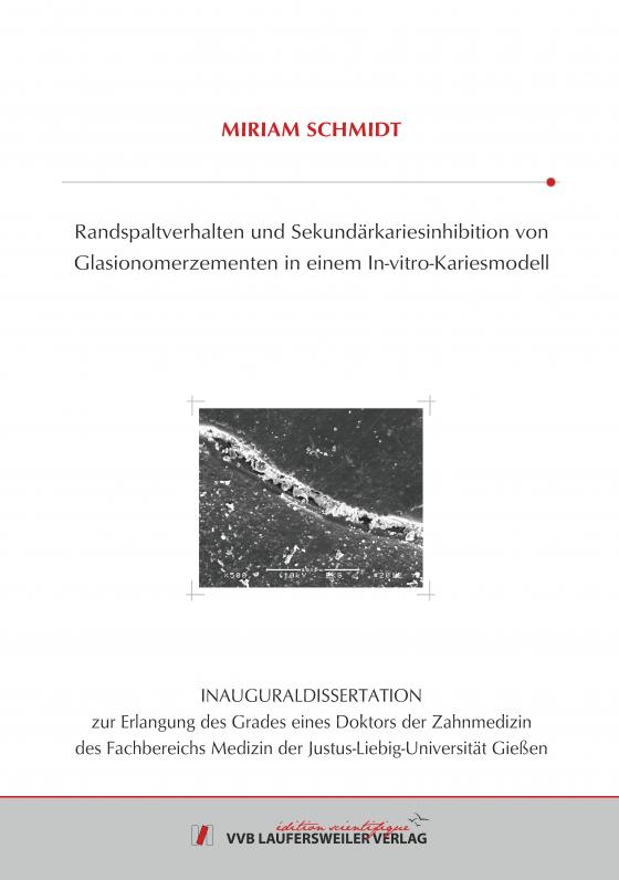 Cover-Bild Randspaltverhalten und Sekundärkariesinhibition von Glasionomerzementen in einem In-vitro-Kariesmodell