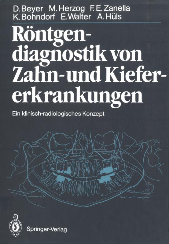 Cover-Bild Röntgendiagnostik von Zahn- und Kiefererkrankungen