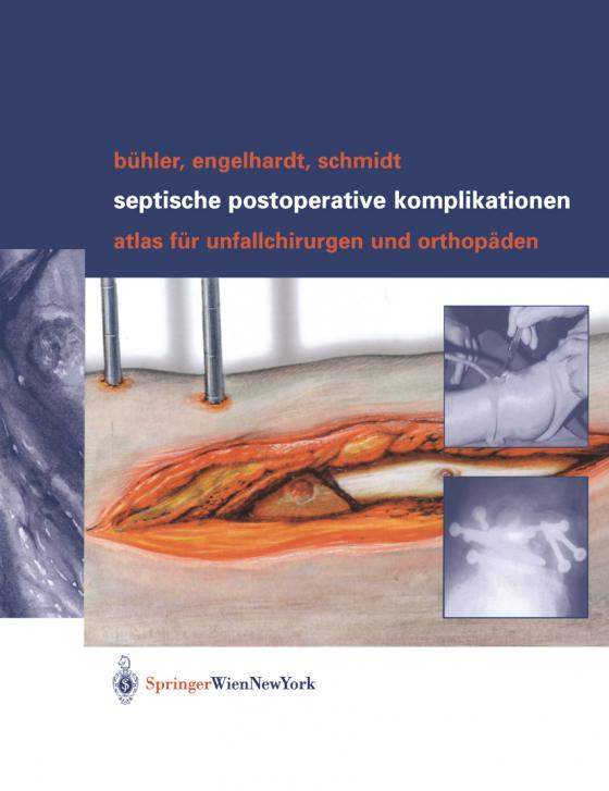 Cover-Bild Septische postoperative Komplikationen