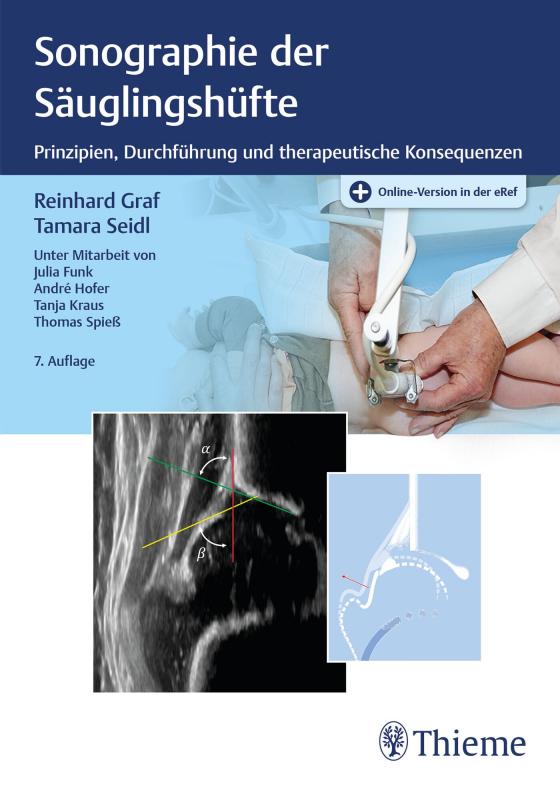 Cover-Bild Sonographie der Säuglingshüfte