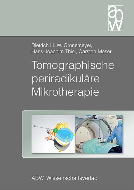 Cover-Bild Tomographische periradikuläre Mikrotherapie