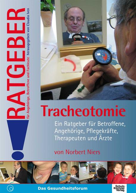 Cover-Bild Tracheotomie