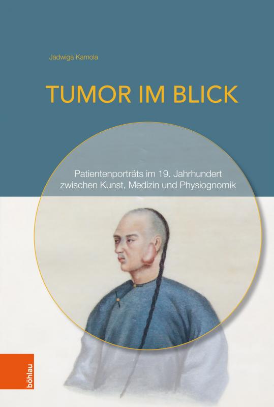 Cover-Bild Tumor im Blick