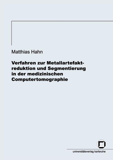 Cover-Bild Verfahren zur Metallartefaktreduktion und Segmentierung in der medizinischen Computertomographie