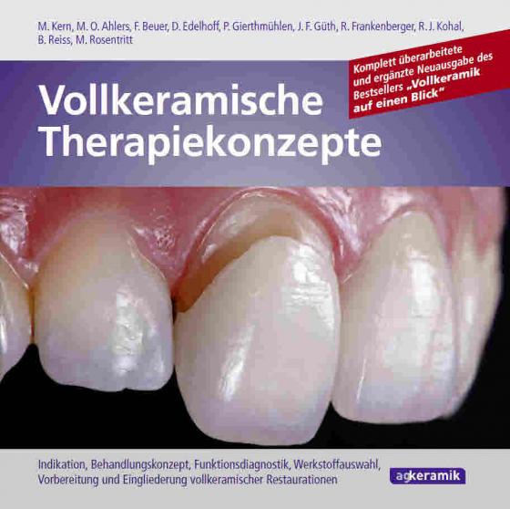 Cover-Bild Vollkeramische Therapiekonzepte